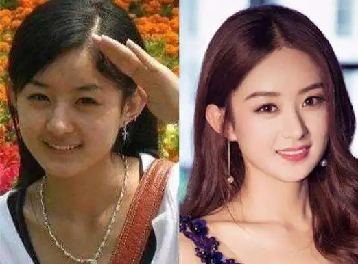 明星出道前后对比图,刘亦菲黑胖邻家小妹,李易峰鞠婧祎判若两人|杨幂