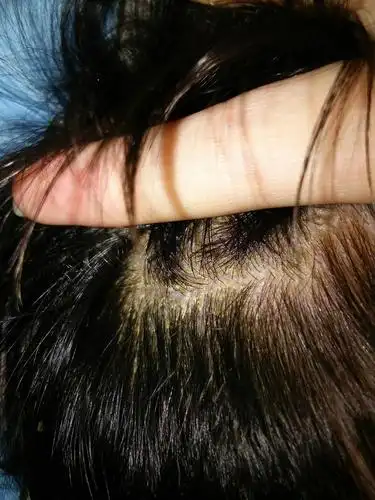 发根这长的是什么