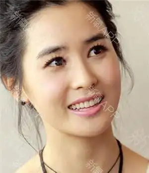 4种标准双眼皮,你做哪种?