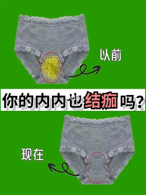 私处瘙痒|白带异常是炎症的表现!