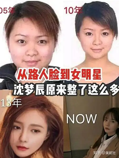 如何评价沈梦辰的颜值变化史