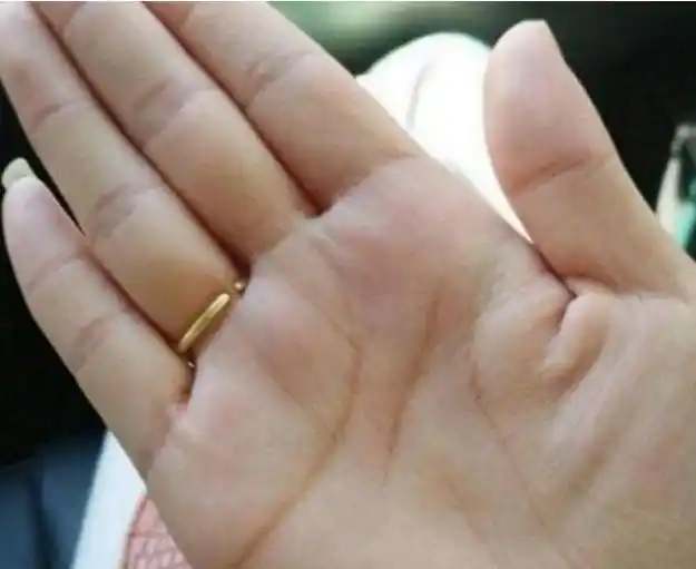 "这根"手指有"此特征,定是大吉之相,富贵命!