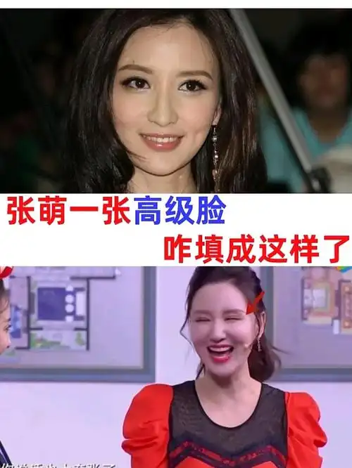 张萌教你面部脂肪填充如何避坑为了拓展人脉才上乘风破_圈子-新氧美容