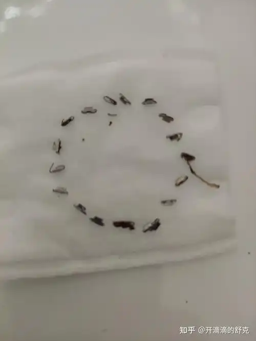 所有的都在这嘞拍个照纪念一下现在就早晚碘酒消毒一下网上买的拆钉器