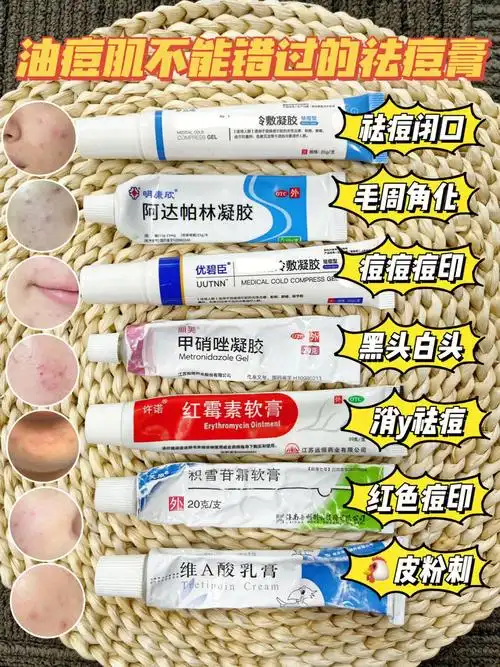 甲硝唑针对:黑头白头5.红霉素针对:消y祛痘6.积雪苷霜针对:红色痘印7.