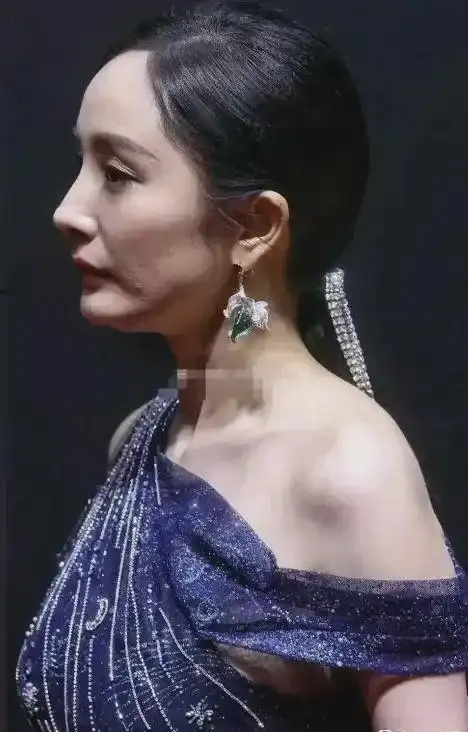 杨幂的脸垮得挺快,嘴一直控制不住地瘪瘪,网友:应该是做了手脚|整容