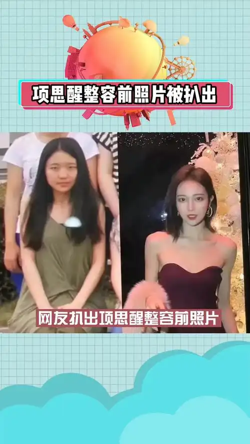 项思醒65页 网友扒出项思醒整容前照片,如果照片是真的,那可谓是只要