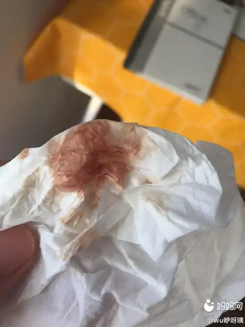 在备孕,排卵期第十二天出褐色分泌物了