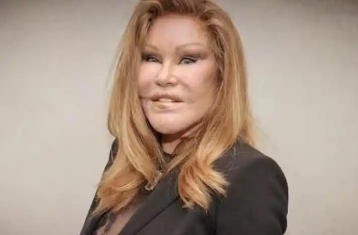 jocelyn wildenstein