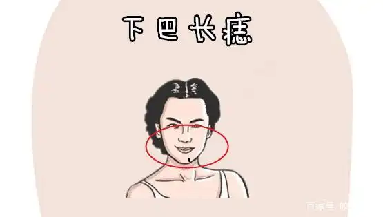 下巴长痣