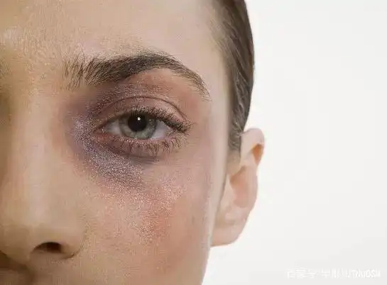 皮肤管理 | 你不是黑,只是皮肤暗沉而已!