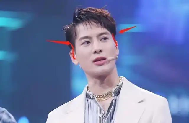 王嘉尔变成牙套脸颧骨外扩太阳穴也凹陷太多明星因此颜值骤降