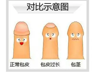 为什么会包茎?