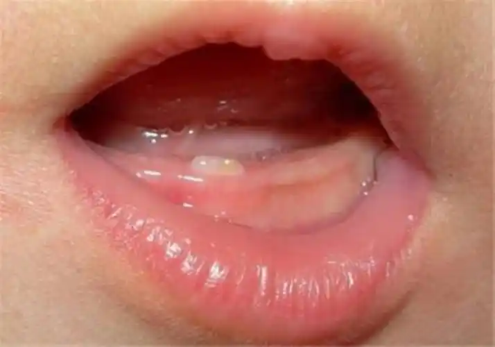 面包干,烤馒头片等,让宝宝磨磨牙龈,帮助宝宝尽快长牙