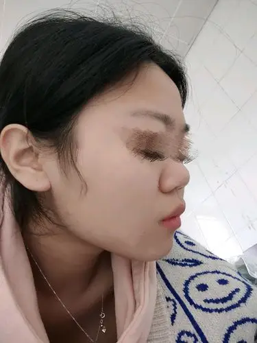 鼻梁塌,没额头,咋整