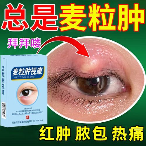 麦粒肿眼药水针眼眼睑炎睑板腺囊肿红肿脓包热痛眼痒流泪干涩堵塞沙眼