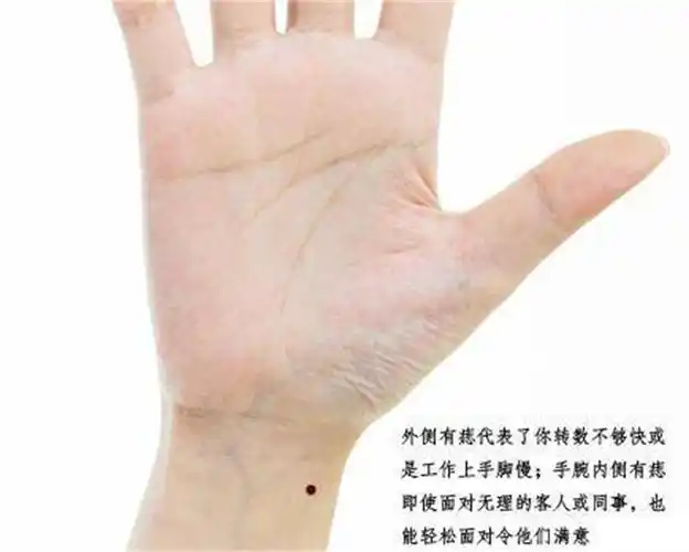 男人在手腕上有痣 是好事还是坏事(手腕有痣)