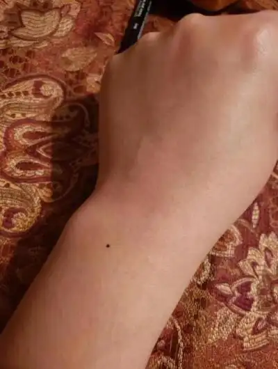手臂中间的痣