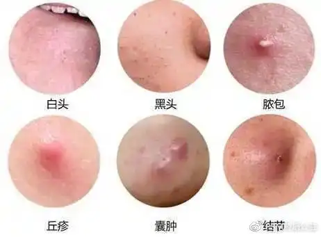 长期戴口罩皮肤发红,发痒,过敏怎么办?药师的自用秘方送给你