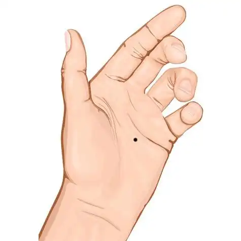 痣相手掌弧有痣(手掌丘有痣代表什么)