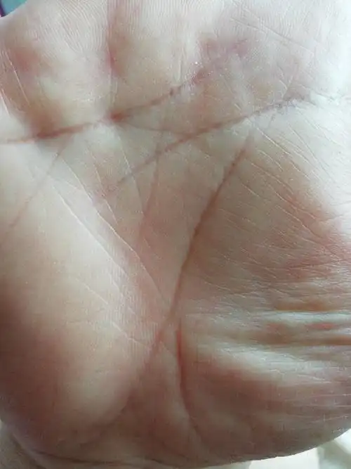 男35岁最近右手生命线岔开了,有懂的大师指点一下需要注意什么