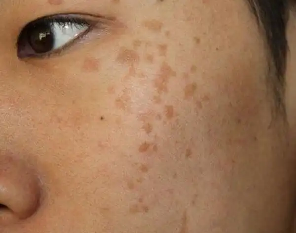 通常脸色差,没血色,身体虚弱等异常,就需要及时就医,检查病因.