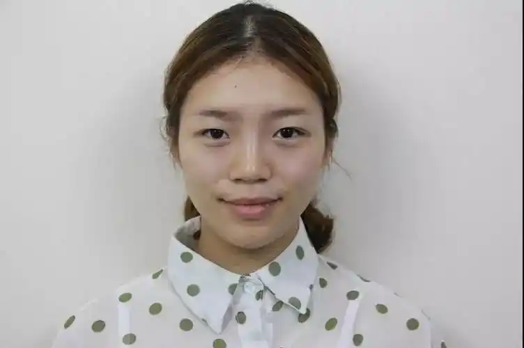 内双的姑娘 眼皮松弛 眼睛无神 做完双眼皮后变化太大了