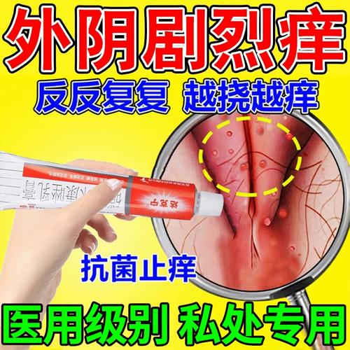 止痒膏克霉唑乳膏阴道炎妇科用药外阴瘙痒克霉软膏抑菌消炎癣症