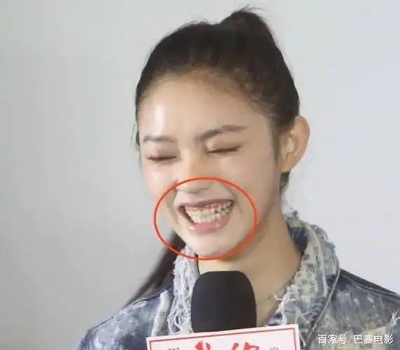 胡歌的整牙对比照,曾经还是蛮青涩的大男孩,但这凸起的虎牙真不太美观