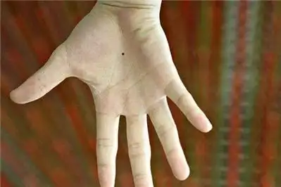 女人右掌心正中间有痣好吗右手心的痣