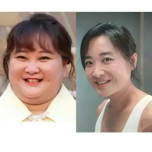 贾玲暴瘦减肥是失败的并不令人羡慕反而让人心疼