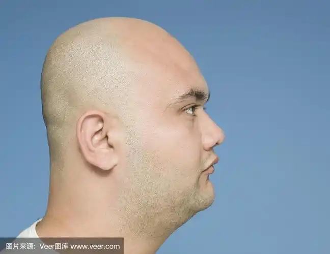 秃头的侧视图