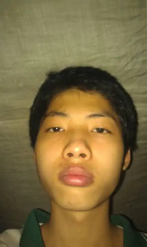 我的脸好丑,有什么改变的办法吗?