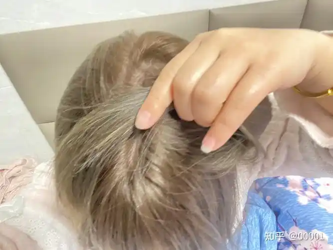 染发爆顶是啥样子的? - 知乎