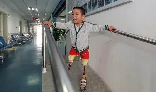 跳小苹果的截肢男孩装上假肢重新站立