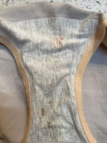 请问下怀孕第24周,双胎,今天内裤上出现了血渍,是什么原因呀