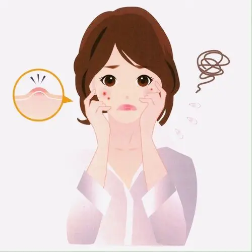 不能挤的闭口难道就这样看着它分布全脸