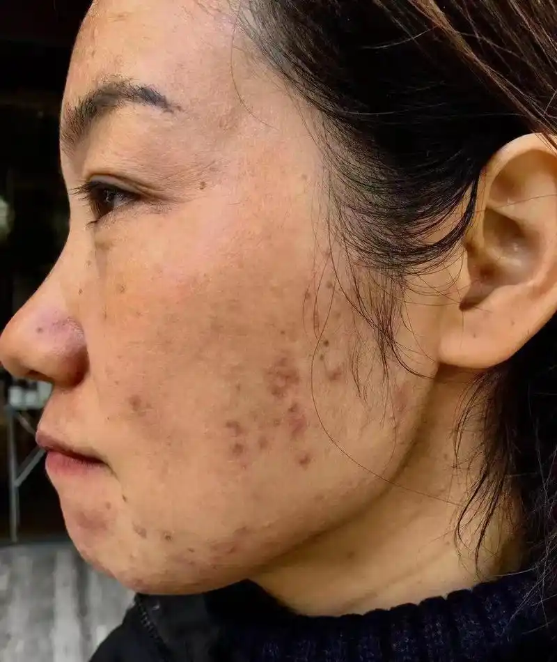 做问题性皮肤我是认真的