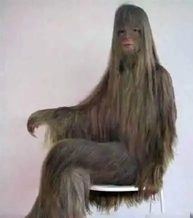 女子天生体毛过长,全身浓密体毛像野人,剃毛后的样子看呆众人