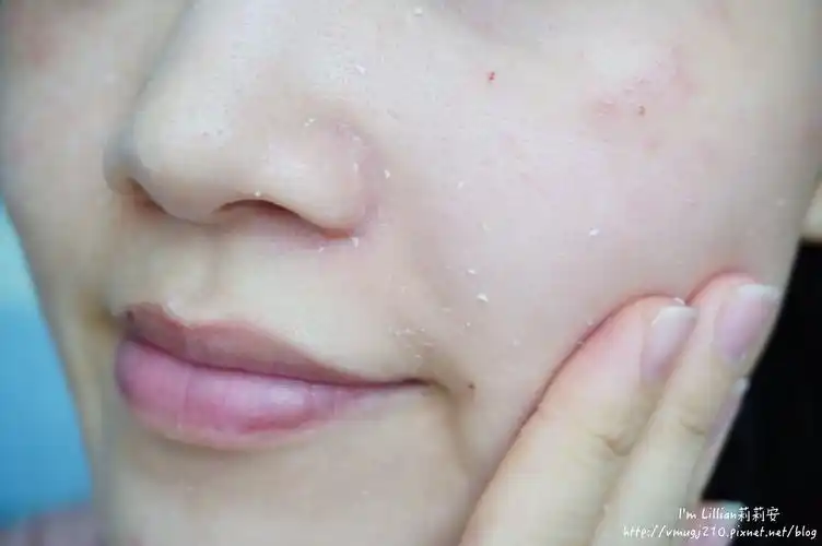 保养|日本热销 cure q儿活性水素水去角质凝露 史上最温和的去角质