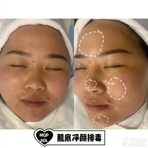 南宁皮肤管理培训班课程