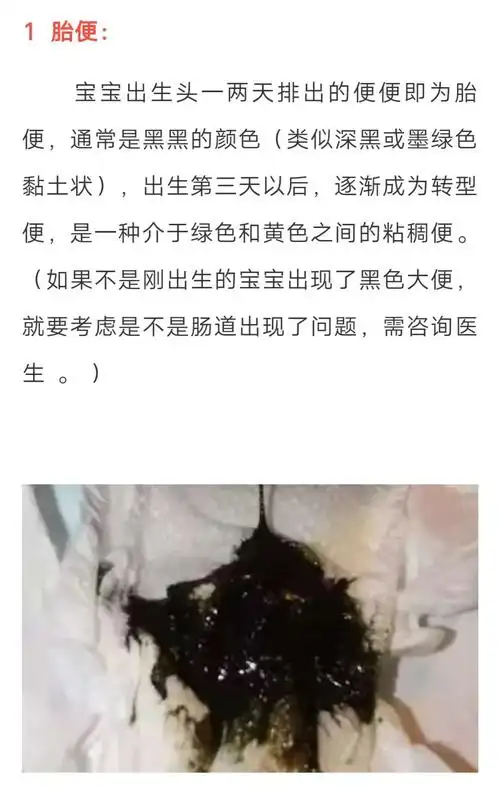 黑便,奶瓣,绿便,腹泻,便秘.宝宝的各种便便真图全解!建议收藏