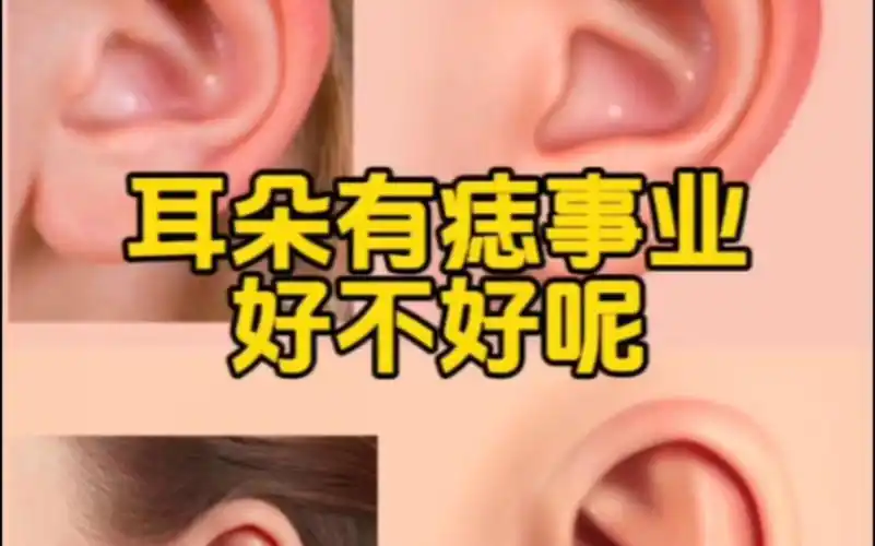 左耳朵有痣的女人情商高,比较善解人意,通常痣在此位的女人,性格很