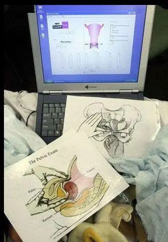 实拍女性私处检查全过程(图)