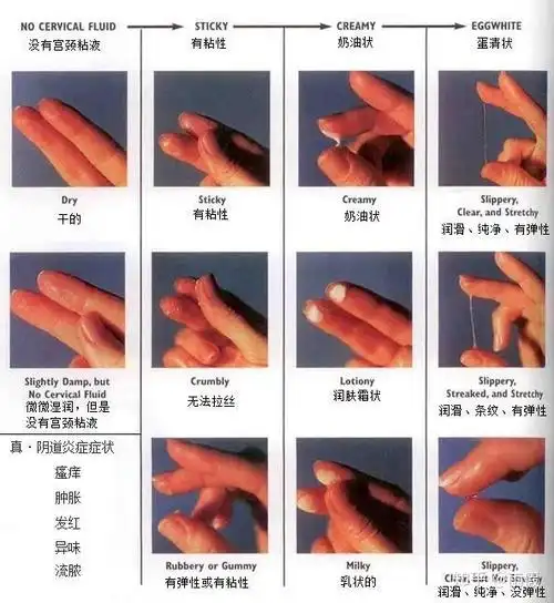 如下:状态:粘稠稀糊状,蛋清样色:透明或白色味:无腥亦无臭正常的白带