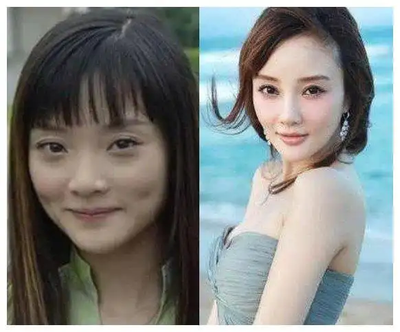 丰唇手术失败?李小璐"怼脸拍"彻底翻车,下嘴唇已经肿得不像样