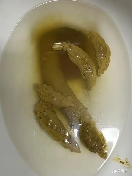 你们见过最大的屎是什么样的? - 知乎