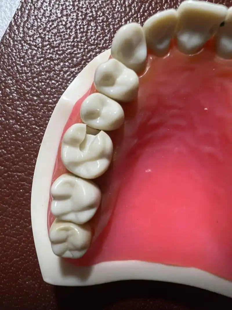 一个绝美的二类洞搭配一个绝美的三类洞 下周就要summative exam了