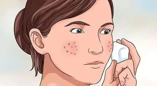 16岁毛孔粗大如何改善 16岁毛孔粗大怎么办-昕薇网