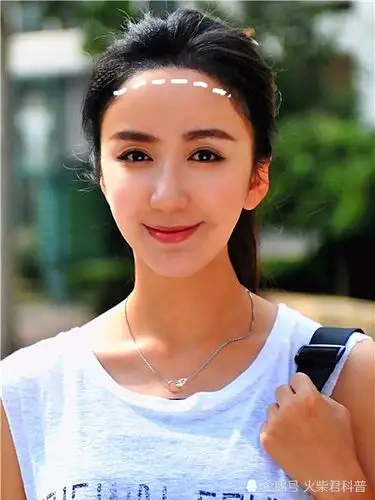 "发际线"太高对女生颜值影响有多大?撩起刘海后,男生拔腿就跑